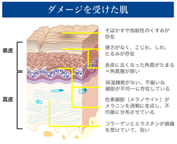 ダメージを受けた肌